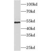 WB analysis of human liver tissue, using PIGB antibody (1/800 dilution).