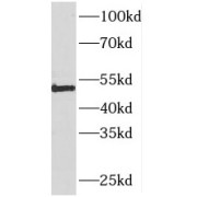 WB analysis of HeLa cells, using PIGM antibody (1/800 dilution).