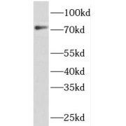 WB analysis of HeLa cells, using PIGO antibody (1/300 dilution).