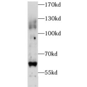 WB analysis of human brain tissue, using PIGZ antibody (1/500 dilution).