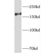 WB analysis of HeLa cells, using PIK3C2B antibody (1/600 dilution).