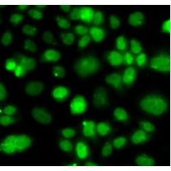 Phosphatidylinositol-5-Phosphate 4-Kinase Type 2 Alpha (PIP4K2A) Antibody