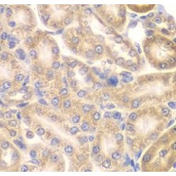 Phosphatidylinositol-5-Phosphate 4-Kinase Type 2 Alpha (PIP4K2A) Antibody