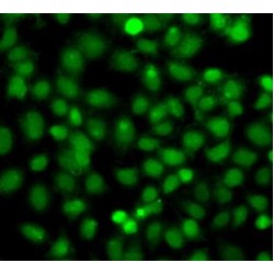 Phosphatidylinositol-4-Phosphate 5-Kinase Type 1 Alpha (PIP5K1A) Antibody