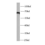 WB analysis of A431 cells, using PIP5K1A antibody (1/1000 dilution).