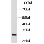 WB analysis of mouse brain tissue, using CSDC2 antibody (1/600 dilution).