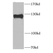 WB analysis of mouse brain tissue, using PITRM1 antibody (1/1000 dilution).