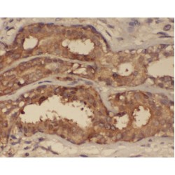 PKC beta Antibody