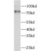 WB analysis of mouse brain tissue, using PKC delta antibody (1/2000 dilution).