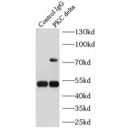 Protein Kinase C Delta (PRKCD) Antibody