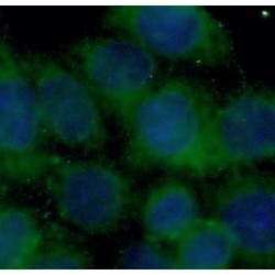 Protein Kinase C Iota Type (PRKCI) Antibody