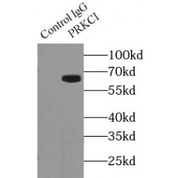 Protein Kinase C Iota Type (PRKCI) Antibody