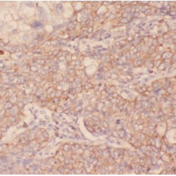 Pyruvate Kinase, Liver And RBC (PKLR) Antibody