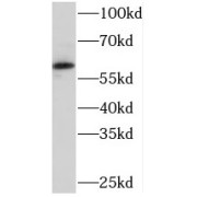 WB analysis of MCF7 cells, using PKLR antibody (1/1000 dilution).