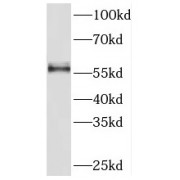 WB analysis of HepG2 cells, using PKM antibody (1/1000 dilution).