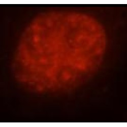 PKM1-specific Antibody