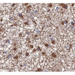 PKM1-specific Antibody