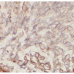 PKM2-specific Antibody
