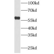 WB analysis of MCF7 cells, using PKM2-specific antibody (1/1500 dilution).