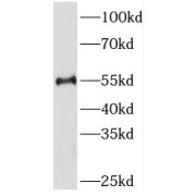 WB analysis of mouse brain tissue, using PKMYT1 antibody (1/500 dilution).