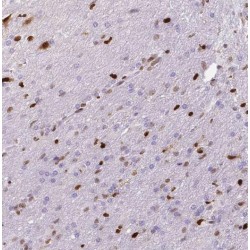PBX/Knotted 1 Homeobox 1 (PKNOX1) Antibody