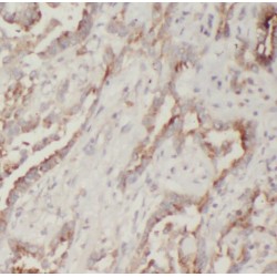 Phospholipase A2, Group XIIA (PLA2G12A) Antibody