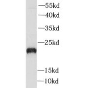 WB analysis of mouse skeletal muscle tissue, using PLA2G12A antibody (1/1000 dilution).