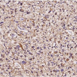 Phospholipase A2 Group IV B (PLA2G4B) Antibody