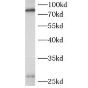 WB analysis of human plasma tissue, using PLA2G4B antibody (1/600 dilution).