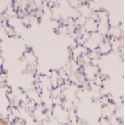 IHC-P analysis of human lung tissue, using PLA2G4F antibody (1/200 dilution).