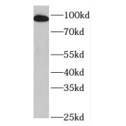 WB analysis of human serum tissue, using plasminogen antibody (1/300 dilution).