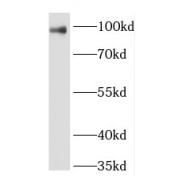 WB analysis of human blood tissue, using Plasminogen antibody (1/2000 dilution).