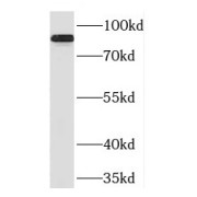 WB analysis of human rectum tissue, using PLCD1 antibody (1/400).