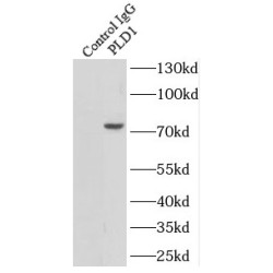 Phospholipase D1 (PLD1) Antibody