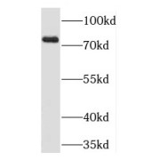 WB analysis of A431 cells, using PRKCSH antibody (1/4000 dilution).
