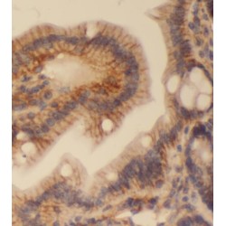 Pleckstrin Homology Domain Containing A1 (PLEKHA1) Antibody