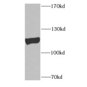WB analysis of mouse lung tissue, using PLK4 antibody (1/1000 dilution).