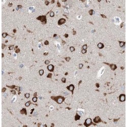 Polo Like Kinase 5 (PLK5) Antibody