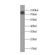 WB analysis of DU 145 cells, using PLOD2-Specific antibody (1/300 dilution).