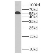 WB analysis of K-562 cells, using PLRG1 antibody (1/1000 dilution).