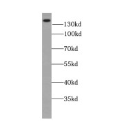 WB analysis of human brain tissue, using ATP2B2 antibody (1/500 dilution).
