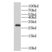 WB analysis of mouse brain tissue, using PMM1 antibody (1/600 dilution).