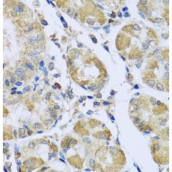 Peptidase, Mitochondrial Processing Beta Subunit (PMPCB) Antibody