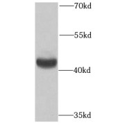 WB analysis of MCF7 cells, using PMPCB antibody (1/1000 dilution).