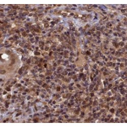 Mismatch Repair Endonuclease PMS2 (PMS2) Antibody