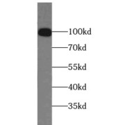 WB analysis of A431 cells, using PMS2 antibody (1/1000 dilution).
