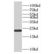 WB analysis of HepG2 cells, using PMVK antibody (1/500 dilution).