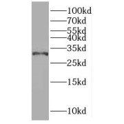 WB analysis of K-562 cells, using PNMT antibody (1/400 dilution).