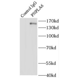 Patatin-Like Phospholipase Domain-Containing Protein 6 (PNPLA6) Antibody
