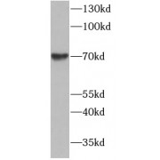 WB analysis of A375 cells subjected to SDS-PAGE, using PODN Antibody (1/500 dilution)